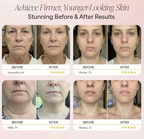 Redmondio™ SculptLift EMS Patches